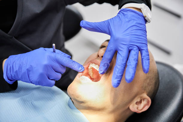 Best Emergency Dentist for Knocked-Out Tooth in Brush, CO