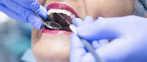 Best Emergency Dental Extractions in Brush, CO